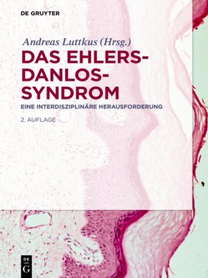cover image of Das Ehlers-Danlos-Syndrom